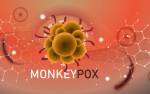 Обявиха извънредна епидемиологична ситуация в Ню Йорк заради маймунската шарка