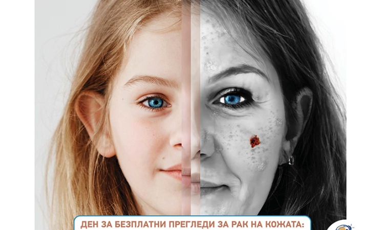 Безплатни профилактични прегледи в Клиниката по кожни и венерически болести