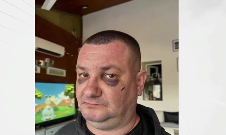 Завързан с белезници и ритан в главата: Мъж твърди, че е жестоко пребит в дискотека в Троян