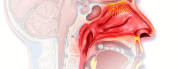 Алергичен ринит – често заболяване, което не бива да се подценява