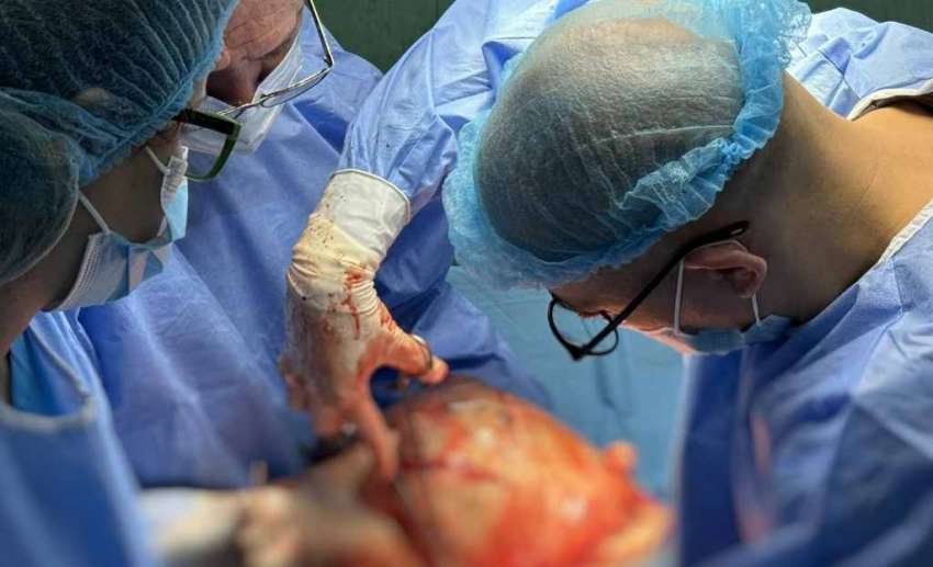 11-килограмова киста оперираха в УСБАЛАГ „Селена“